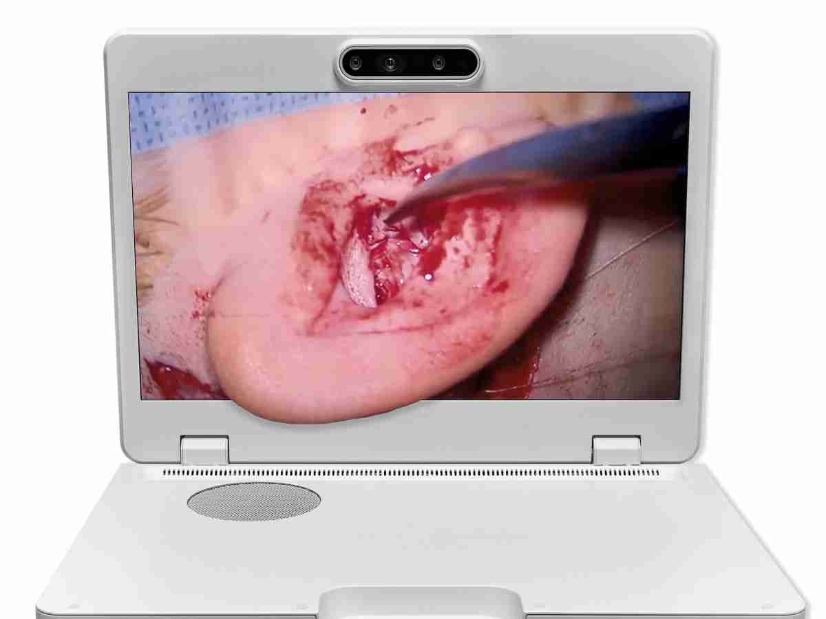 达擎之＂Heads-up 3D显微手术显示系统＂，，整合4K裸眼3D显示及眼球追踪系统，，，，具备快速追踪人眼移动位置功能，，，，减轻医师长时间维持固定姿势的负担，，让医师能有更宽广清晰的3D立体视野及更舒适的姿势来执行手术。。。。